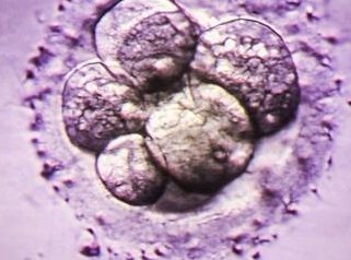 在包头子宫内膜厚必须要刮宫吗？