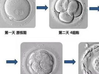 夫妻对做试管有抵触的感觉正常吗？