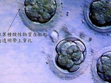 2026吉首市最新男性陪产假有多少天？试管婴儿可以增加产假吗？